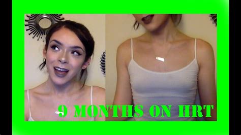 teen tits nude|Normal Breast Development and Changes